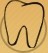 Dentikulas